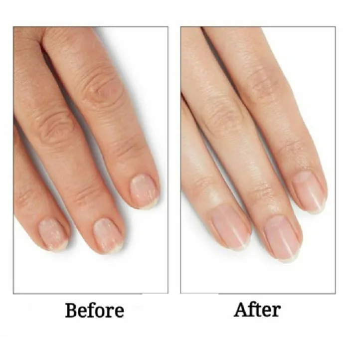 7 Cách dưỡng móng sau khi tháo gel đơn giản, hiệu quả