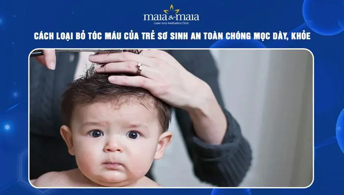 Có nên cắt tóc máu cho trẻ sơ sinh không? Lưu ý cần biết