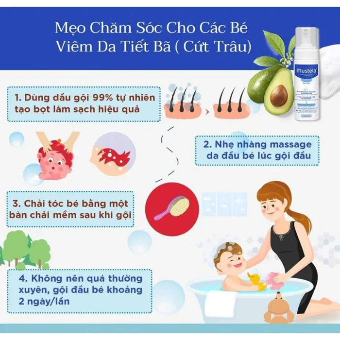 Dầu Gội Ngăn Ngừa Cứt Trâu Cho Trẻ Sơ Sinh & Em Bé Mustela 150ml | Shopee  Việt Nam