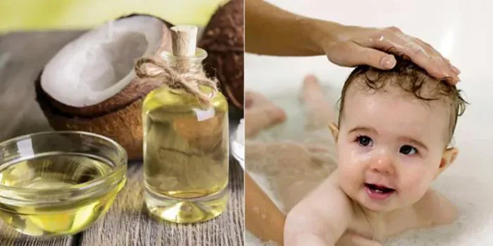 10+ mẹo đơn giản loại bỏ “cứt trâu” trên đầu trẻ siêu hiệu quả