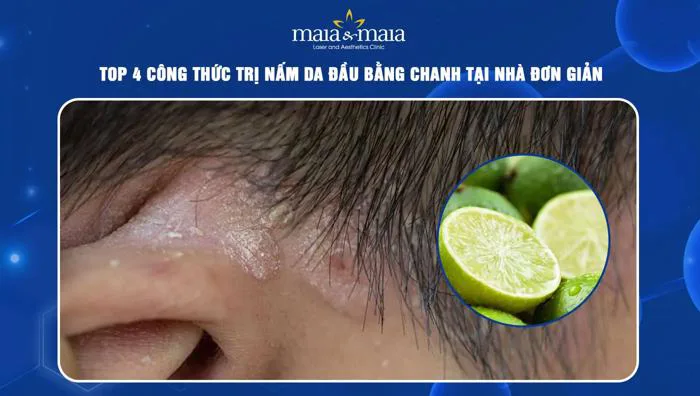 cach-vat-nuoc-chanh-goi-dau-sach-nam-be-1