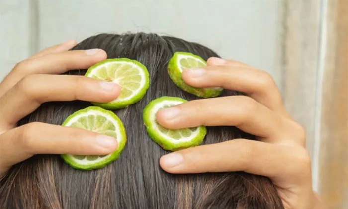 Gội đầu bằng chanh có tác dụng gì? Bí quyết trị gàu bằng chanh hiệu quả –  Biocarepharma