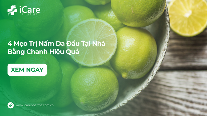 Trị Nấm Da Đầu Tại Nhà Bằng Chanh Hiệu Quả - 4 Mẹo Bạn Nên Áp Dụng