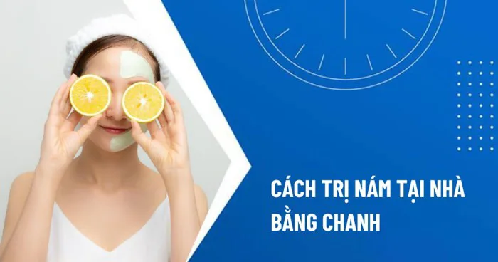 13 cách trị nám bằng chanh tại nhà được nhiều người áp dụng
