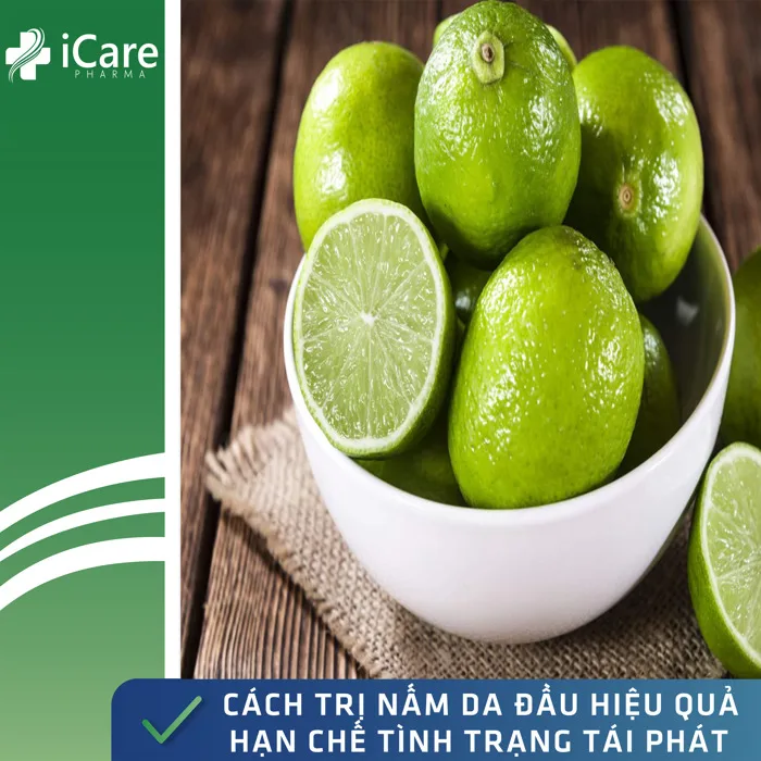 Bật Mí Cách Chữa Nấm Đầu Hiệu Quả, Hạn Chế Tình Trạng Tái Đi Tái Lại Nhiều  Lần - iCare Pharma