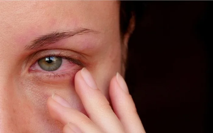 Mẹ đang cho con bú có nhuộm tóc được không? Cực kỳ có hại