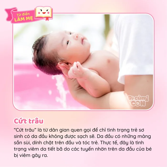 Cứt trâu' trên đầu trẻ sơ sinh là gì? - Sức khỏe & Chăm sóc - Đi cùng con