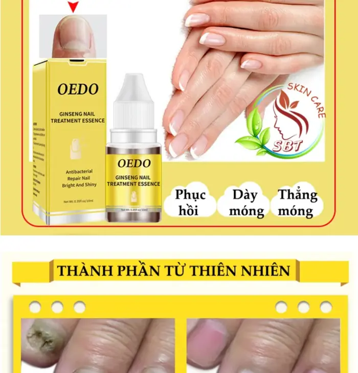 [CHĂM SÓC MÓNG] Tinh Dầu Dưỡng Móng Tay, Móng Chân OEDO Chai 10ml – Loại Bỏ  Nấm, Phục Hồi Móng Hư Tổn, Cho Móng Thẳng Chắc Khỏe, Chiết Xuất Từ Thảo ...