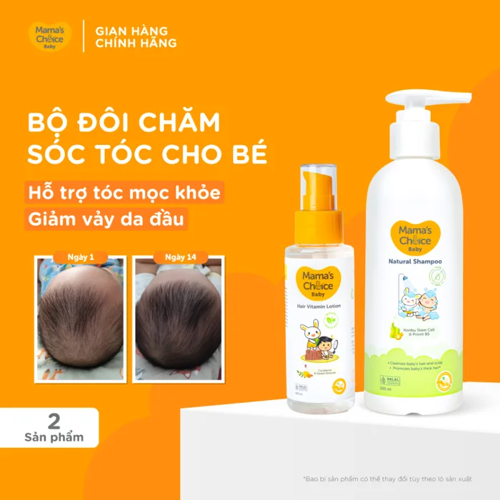 Dầu Gội Trẻ Em Mama’s Choice – Dịu Nhẹ Giúp Mọc Tóc Cho Bé Từ 0 Tháng, Làm  Sạch Vảy Da Đầu & Nuôi Dưỡng Da Đầu