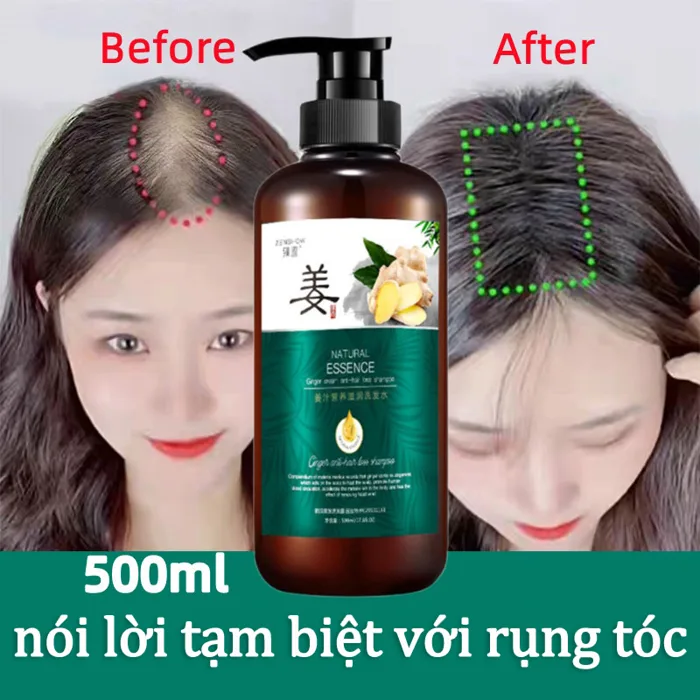 Dầu gội kích thích mọc tóc Dầu gội mọc tóc Giảm Gãy Rụng nơi rụng tóc