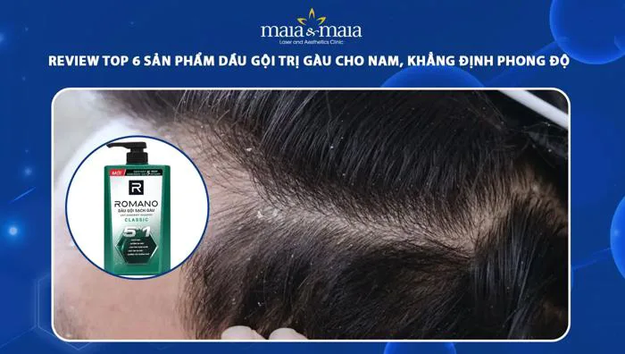 Review TOP 6 sản phẩm dầu gội trị gàu cho nam, phong độ cao Review TOP 6 sản phẩm dầu gội trị gàu cho nam, phong độ cao