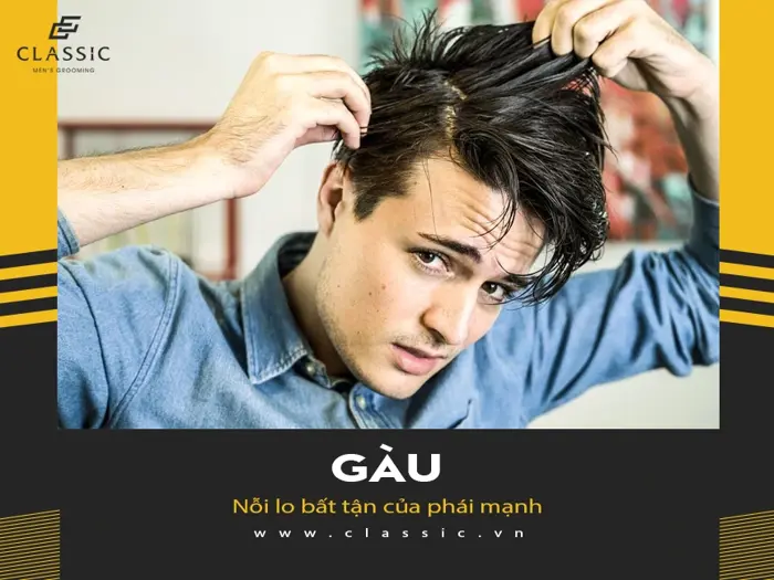 Top 5 chai dầu gội trị gàu cho nam giới tốt nhất hiện nay Top 5 chai dầu gội trị gàu cho nam giới tốt nhất hiện nay