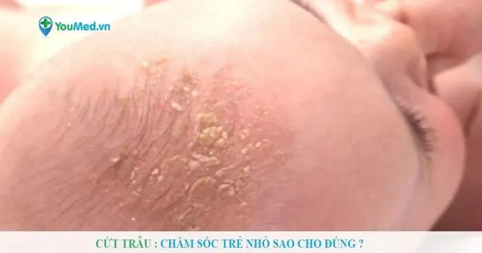 Cứt trâu: Chăm sóc trẻ nhỏ sao cho đúng ? Cứt trâu: Chăm sóc trẻ nhỏ sao cho đúng ?