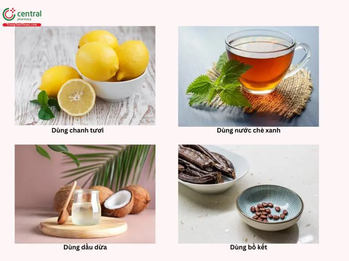 Cứt trâu (viêm da tiết bã) em bé là gì? Cách trị cứt trâu cho trẻ sơ sinh Cứt trâu (viêm da tiết bã) em bé là gì? Cách trị cứt trâu cho trẻ sơ sinh