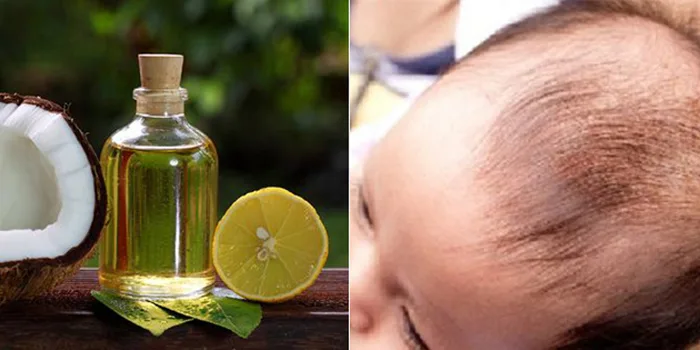 Cách dùng dầu dừa loại bỏ 'cứt trâu' cho bé Cách dùng dầu dừa loại bỏ 'cứt trâu' cho bé