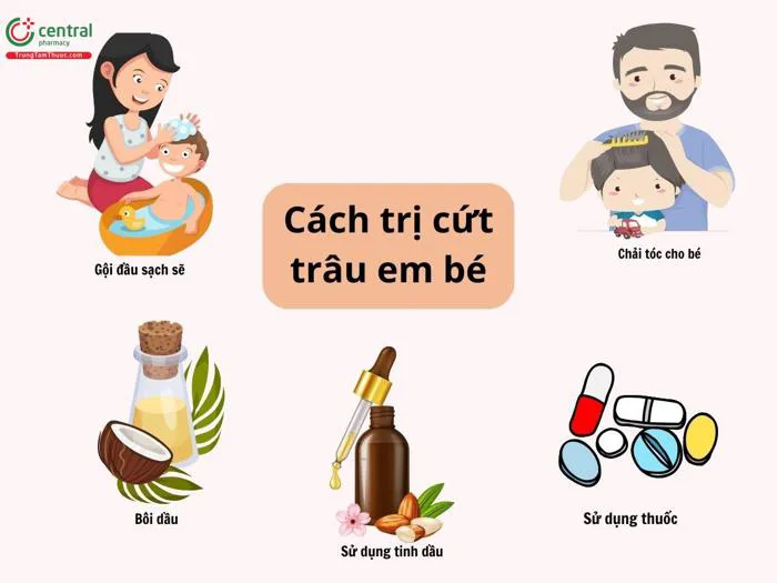Cứt trâu (viêm da tiết bã) em bé là gì? Cách trị cứt trâu cho trẻ sơ sinh Cứt trâu (viêm da tiết bã) em bé là gì? Cách trị cứt trâu cho trẻ sơ sinh