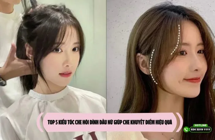TOP 5 kiểu tóc che hói đỉnh đầu nữ giúp che khuyết điểm hiệu quả