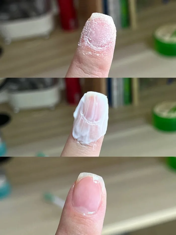 3 Cách Gỡ Móng Tay Giả Tại Nhà Không Đau, Đơn Giản Ai Cũng Làm Được