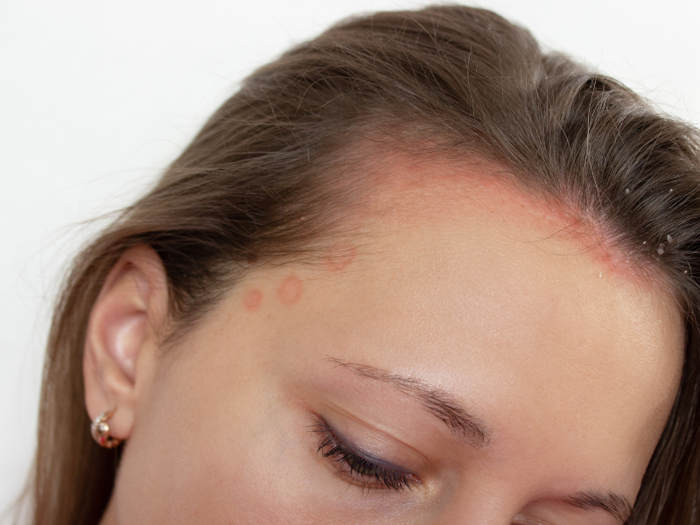 Chấm chân tóc không hại da dầu ở đâu vừa đẹp lại an toàn? - Omnia Hair  Boutique - Salon tóc organic tại Hà Nội