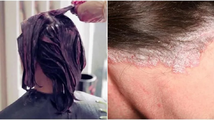 Những lưu ý để bảo vệ tóc và da đầu khi làm đẹp đón Tết