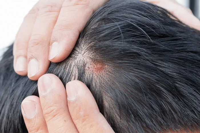 Những tác hại khó lường của việc nhuộm tóc mà bạn nên biết