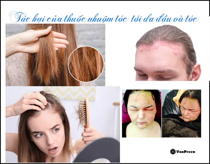 Thuốc nhuộm tóc nào không độc hại
