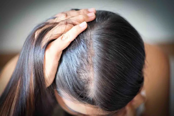 Nhuộm tóc có làm tóc rụng nhiều hơn
