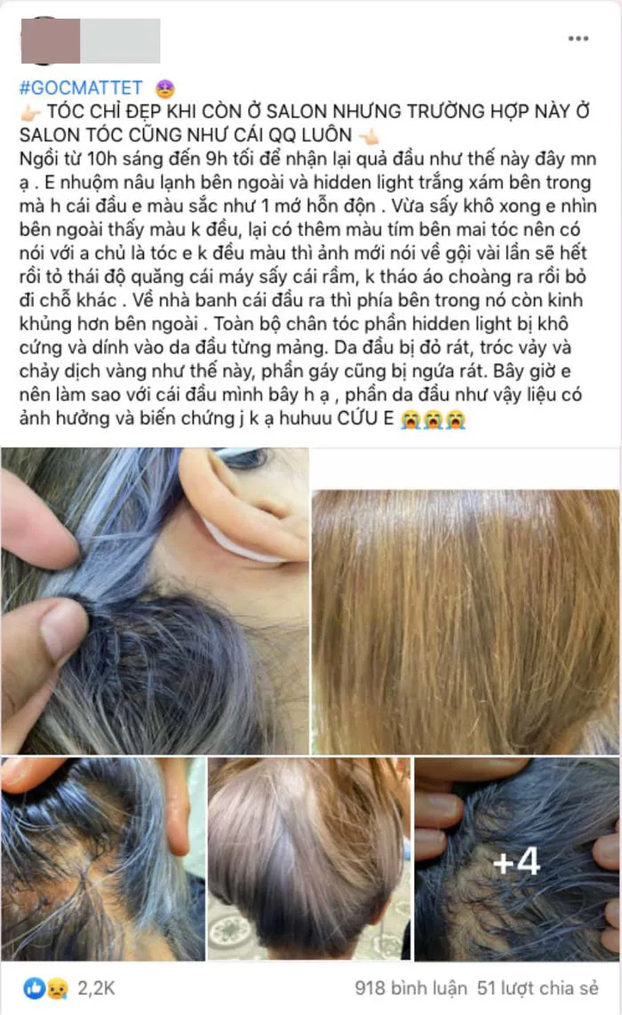 Tẩy tóc chơi Tết, ngồi 11 tiếng nhận về cái kết cháy da đầu, chảy dịch mủ