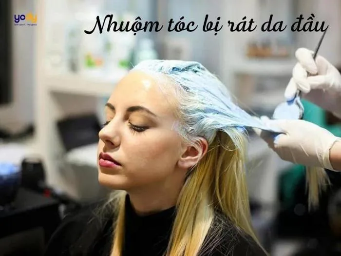 Nguyên nhân nhuộm tóc bị rát da đầu và cách khắc phục | Yody