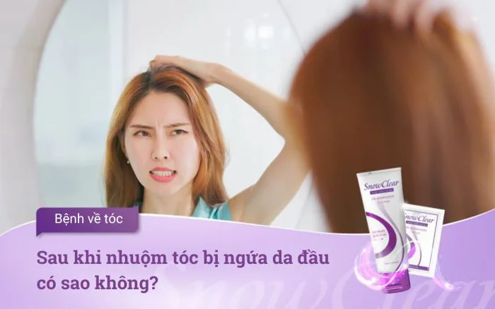 Sau khi nhuộm tóc bị ngứa da đầu có sao không?