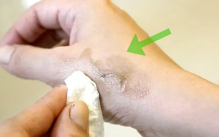Thuốc nhuộm tóc dính vào da bao lâu thì hết? 7 cách tẩy đơn giản Thuốc nhuộm tóc dính vào da bao lâu thì hết? 7 cách tẩy đơn giản