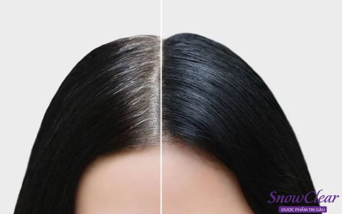 Tóc nhuộm đen bị phai màu phải làm sao? Tóc nhuộm đen bị phai màu phải làm sao?