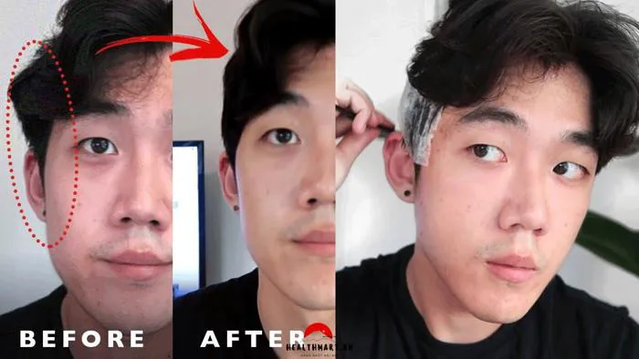 Ép Side tóc nam side part bao nhiêu tiền 2023 - Healthmart.vn