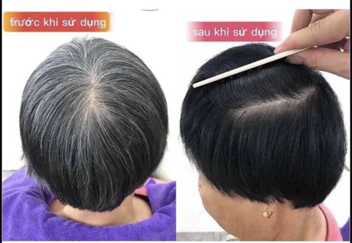 Gợi Ý 10+ Thuốc Nhuộm Đen Tóc Cho Người Già An Toàn & Hiệu Quả