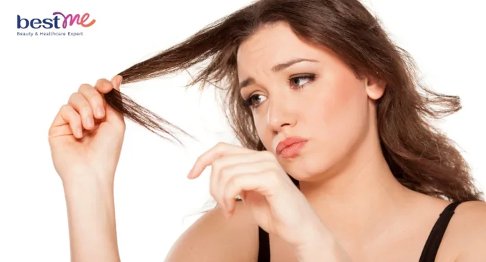 Tóc bị cháy nắng: Dấu hiệu nhận biết và cách khắc phục