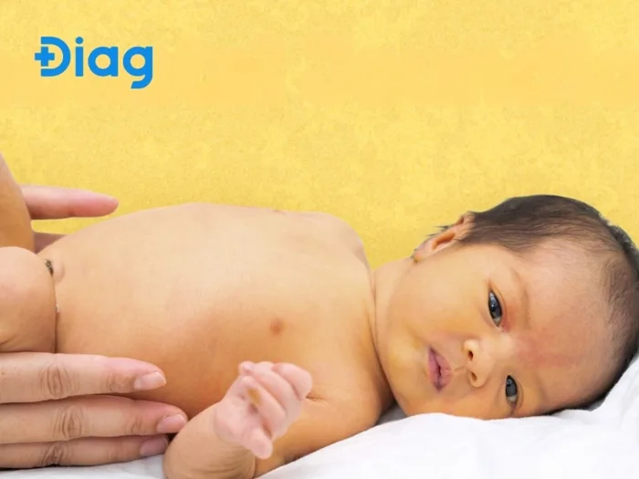 Da bị vàng là thiếu chất gì? Em bé bị vàng da là thiếu chất gì?