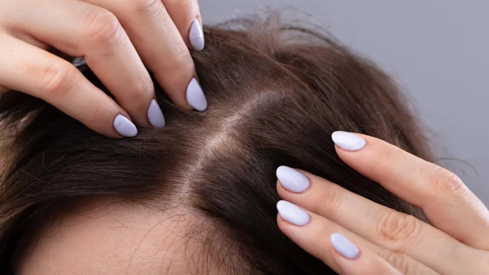 Giải đáp] Da bị vàng là thiếu chất gì? | Nhà thuốc Long Châu