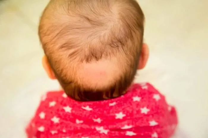 Giải đáp: Trẻ bị rụng tóc là thiếu chất gì và cách khắc phục ra sao?