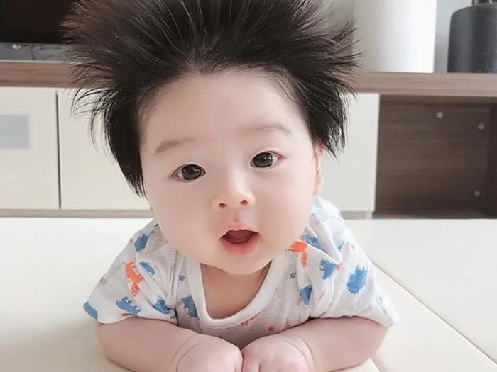 Tóc trẻ sơ sinh mọc dựng đứng kèm theo biểu hiện này cần đi khám bác