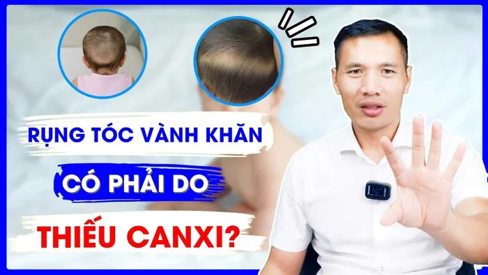 Bé RỤNG TÓC VÀNH KHĂN có phải do THIẾU CANXI? Cách chọn canxi bổ sung cho  bé | DS Trương Minh Đạt