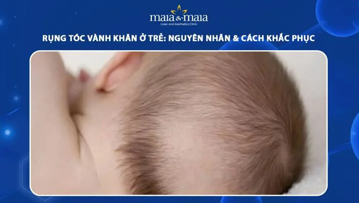 Rụng tóc vành khăn ở trẻ: Nguyên nhân & cách Khắc phục
