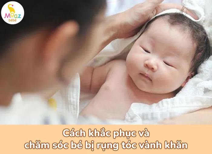 Rụng tóc vành khăn ở trẻ sơ sinh: Nguyên nhân và cách khắc phục