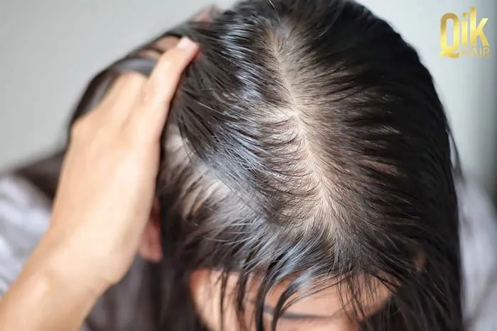 9 cách trị tóc thưa mỏng cho nam, nữ: Nguyên nhân và chăm sóc 9 cách trị tóc thưa mỏng cho nam, nữ: Nguyên nhân và chăm sóc