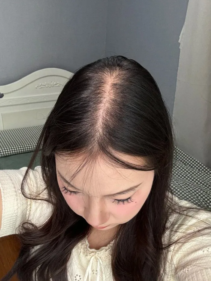 Tóc xẹp lép và thưa thớt, chị em áp dụng 3 cách này tóc phồng tức thì, trông dày đẹp như dòng suối Tóc xẹp lép và thưa thớt, chị em áp dụng 3 cách này tóc phồng tức thì, trông dày đẹp như dòng suối