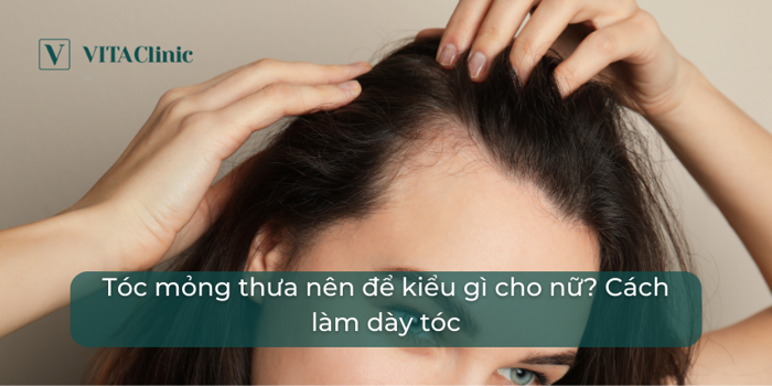 Tóc mỏng thưa nên để kiểu gì cho nữ? Cách làm dày tóc - VITA Clinic Tóc mỏng thưa nên để kiểu gì cho nữ? Cách làm dày tóc - VITA Clinic