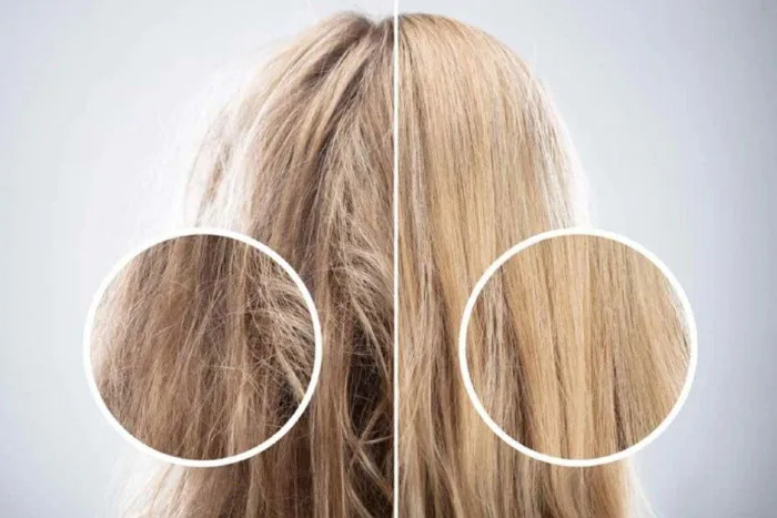 Tóc rụng, mỏng và cách xử trí Tóc rụng, mỏng và cách xử trí