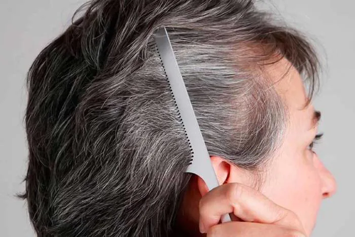 Rụng tóc nhiều ở tuổi trung niên là do đâu? Rụng tóc nhiều ở tuổi trung niên là do đâu?