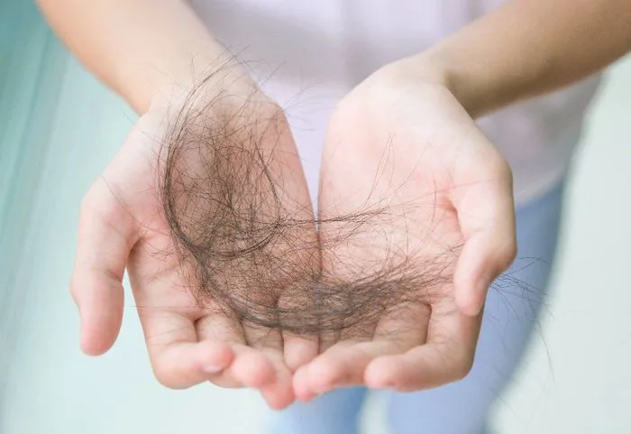 Nguyên nhân và cách xử lý rụng tóc ở trẻ em | Vinmec Nguyên nhân và cách xử lý rụng tóc ở trẻ em | Vinmec