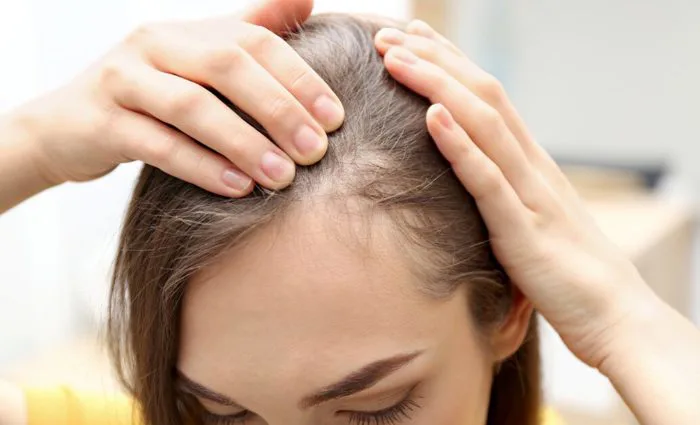 5 thói quen gây hại khiến mái tóc mỏng đi 5 thói quen gây hại khiến mái tóc mỏng đi