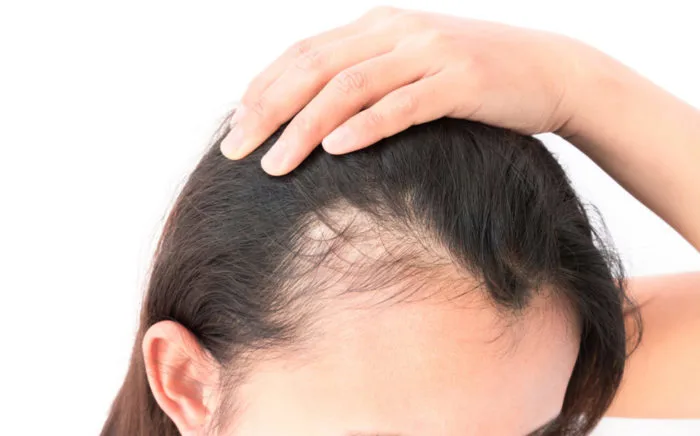Cách xử lý rụng tóc ở trẻ - Borome Cách xử lý rụng tóc ở trẻ - Borome